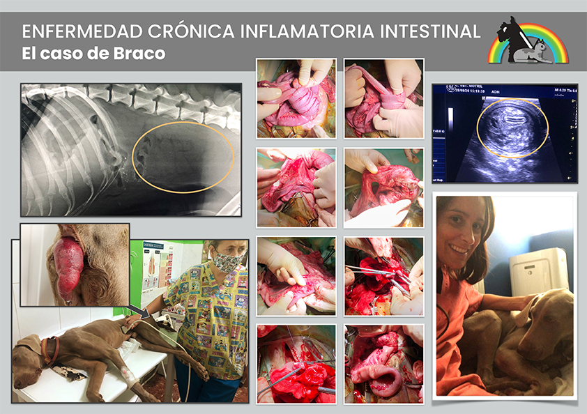 EL CASO CLÍNICO DE BRACO